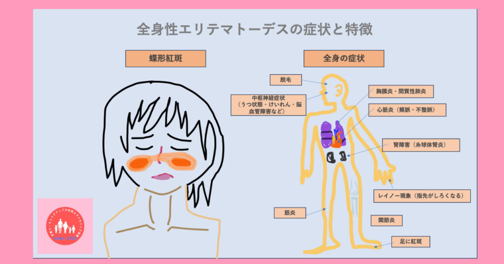 40代女性が寛解と再燃をくり返す全身性エリテマトーデスとは|症状とメカニズム解説【内科医監修】 - Osaka-Child Rebirth Lab