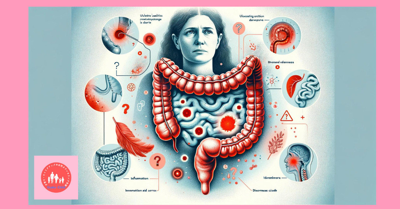 ulcerative-colitis-treatment