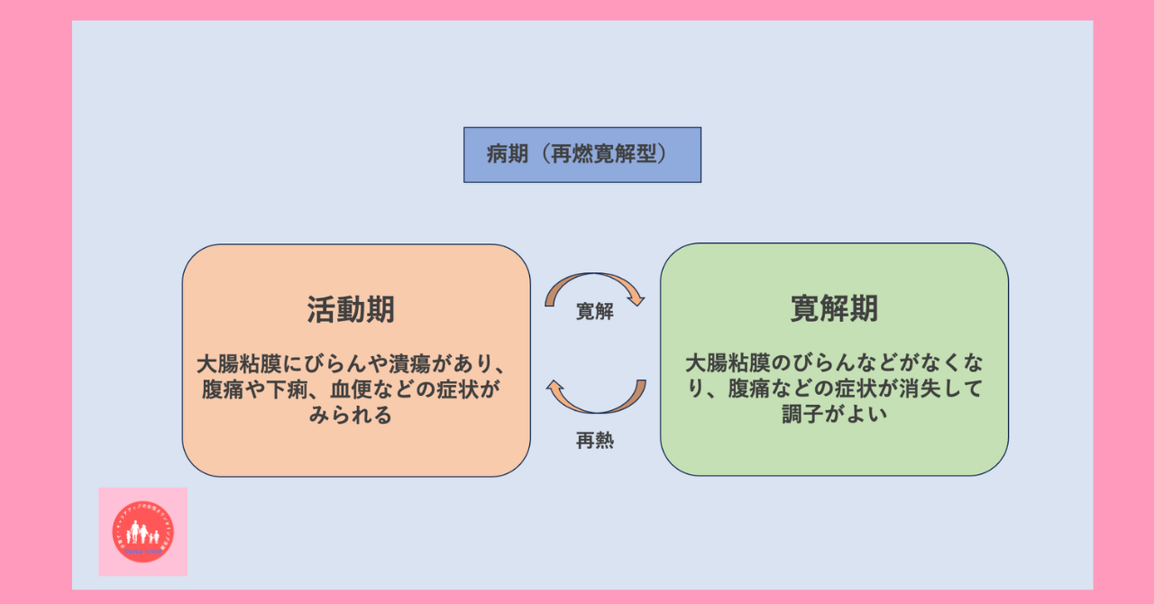 ulcerative-colitis-treatment