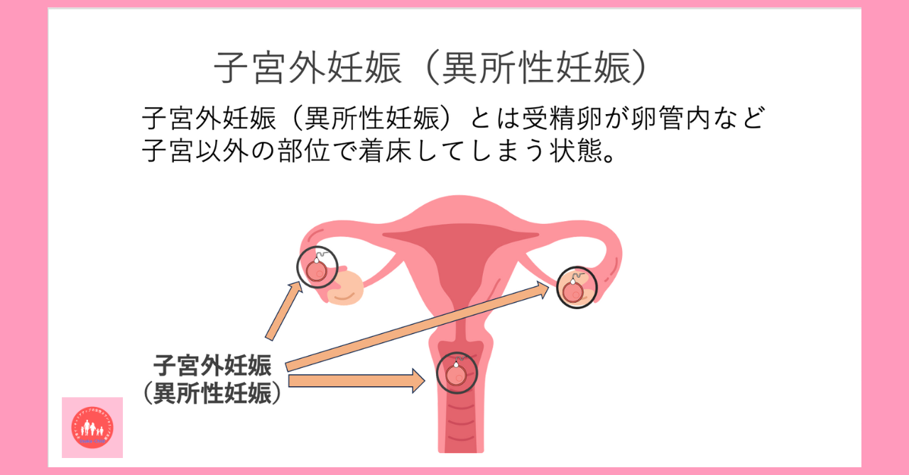 40s-women-in-vitro-fertilization-risks