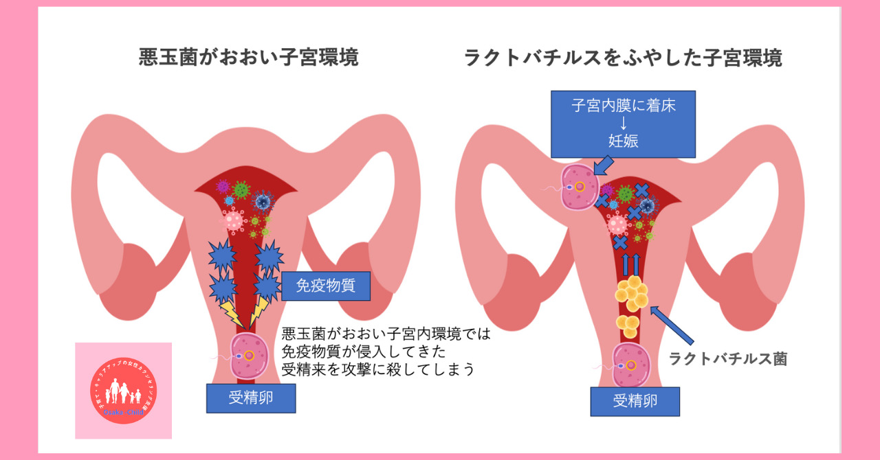 endometrial-flora-test