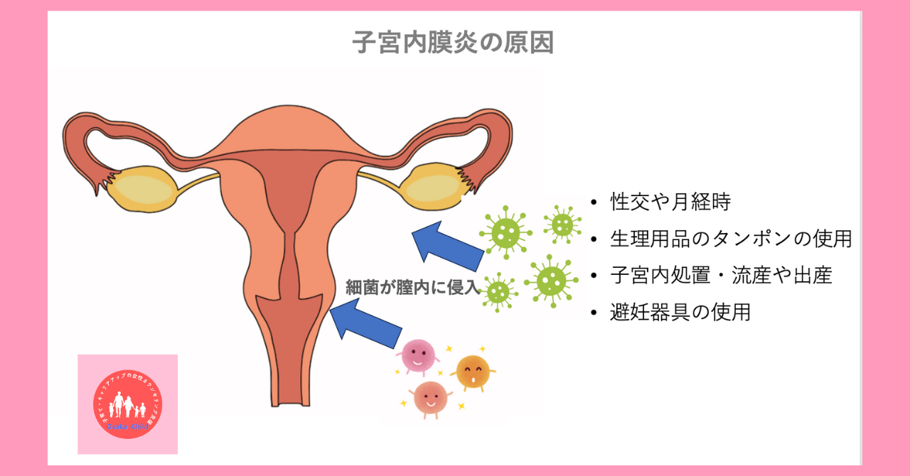 chronic-endometritis-infertility-cause