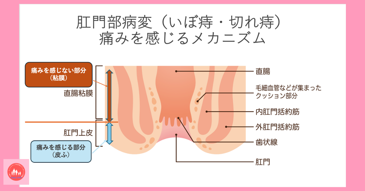 postpartum-buttock-pain-anal-lesions