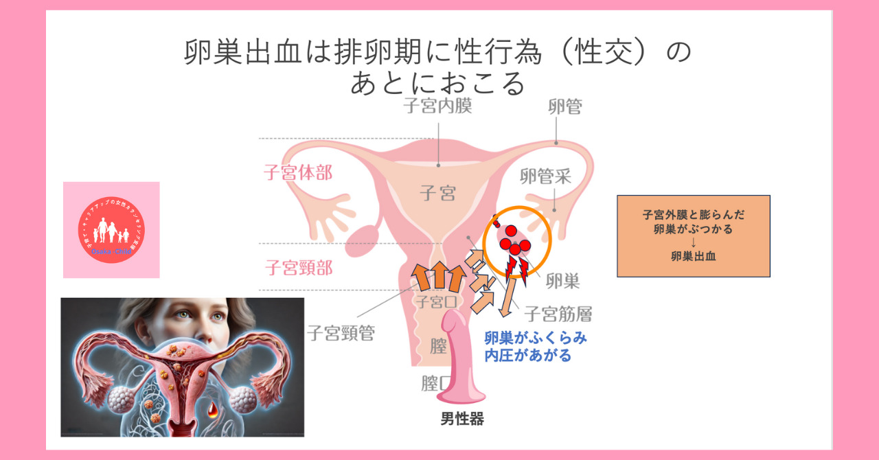 ovarian-bleeding-sexual-intercourse