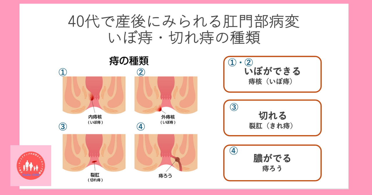 postpartum-buttock-pain-anal-lesions