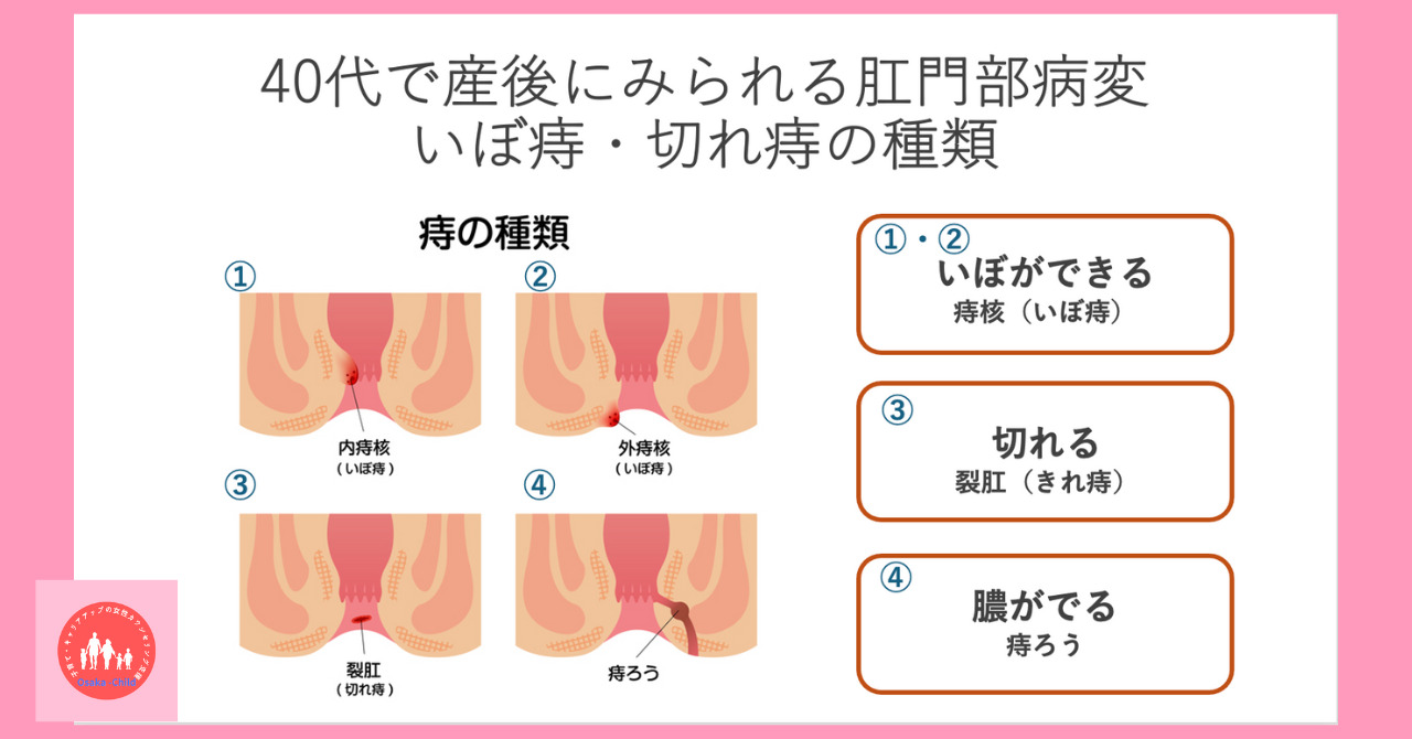 fecal-incontinence-cause