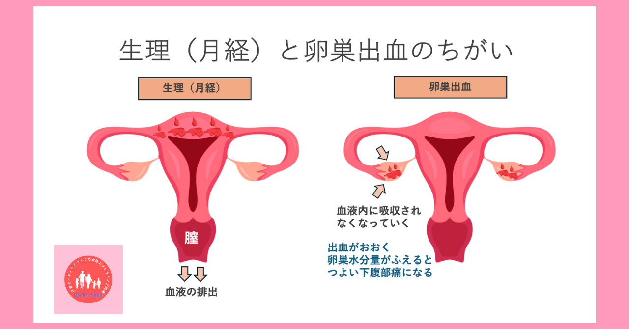 ovarian-bleeding-sexual-intercourse