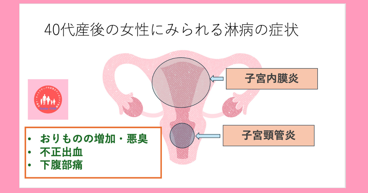 postpartum-gonorrhea-cause