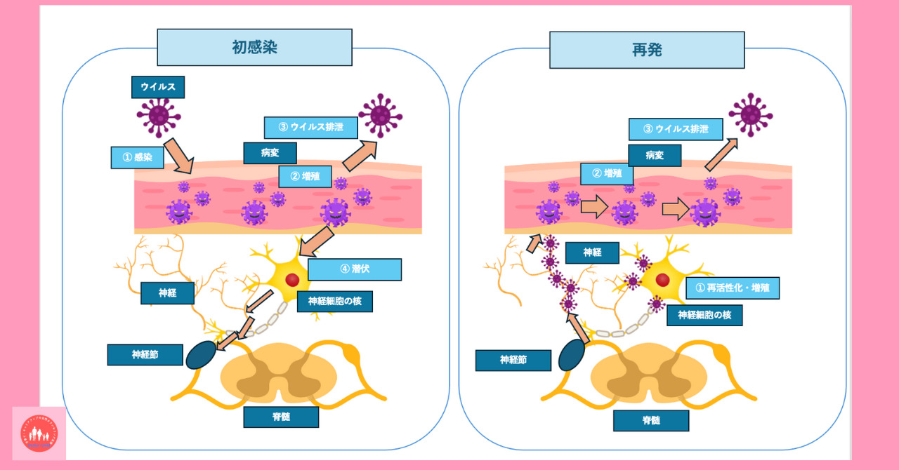 postpartum-simple-herpes-virus-infection-cause