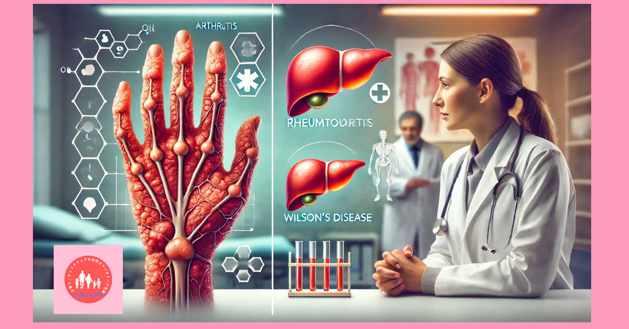 immune-system-related-drug-penicillamine