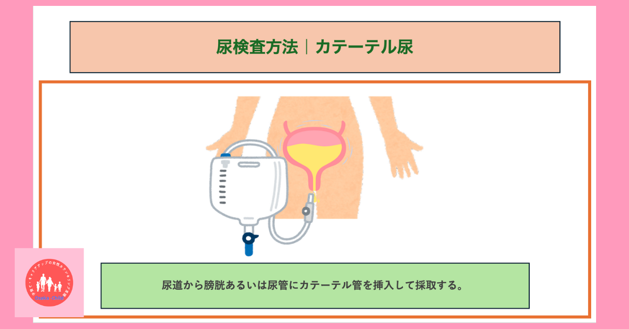 urinalysis-what-you-can-learn-urine-sample-method