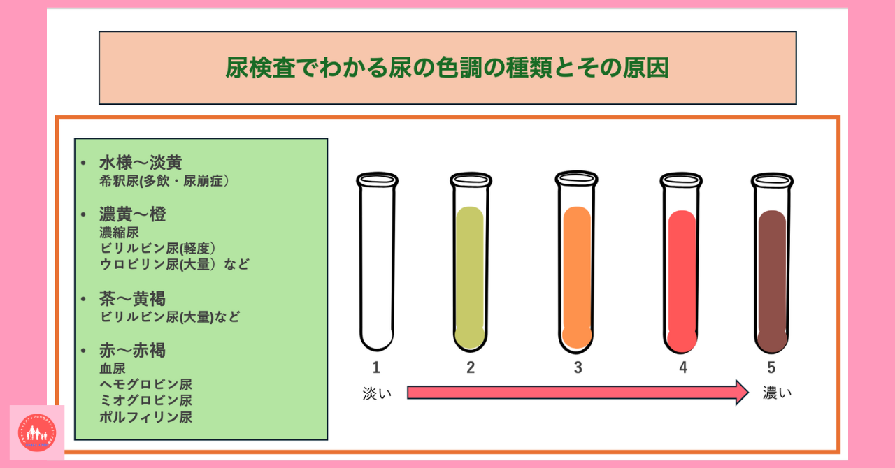 urine-test-what-you-can-learn-urine-cloudy-causes